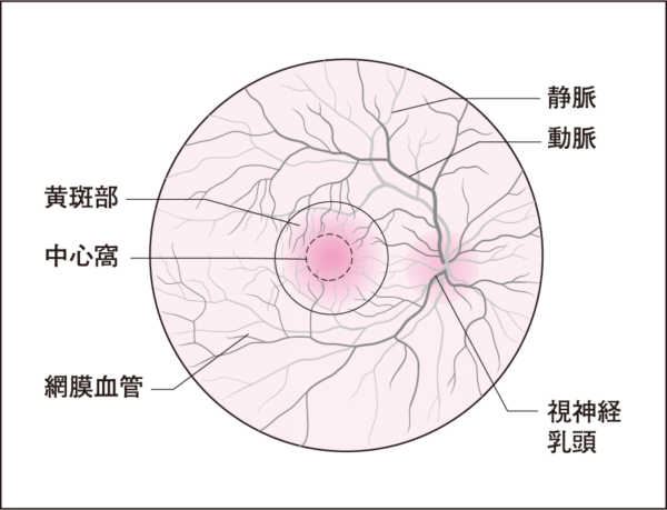 眼底図1